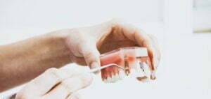 Dental Implant